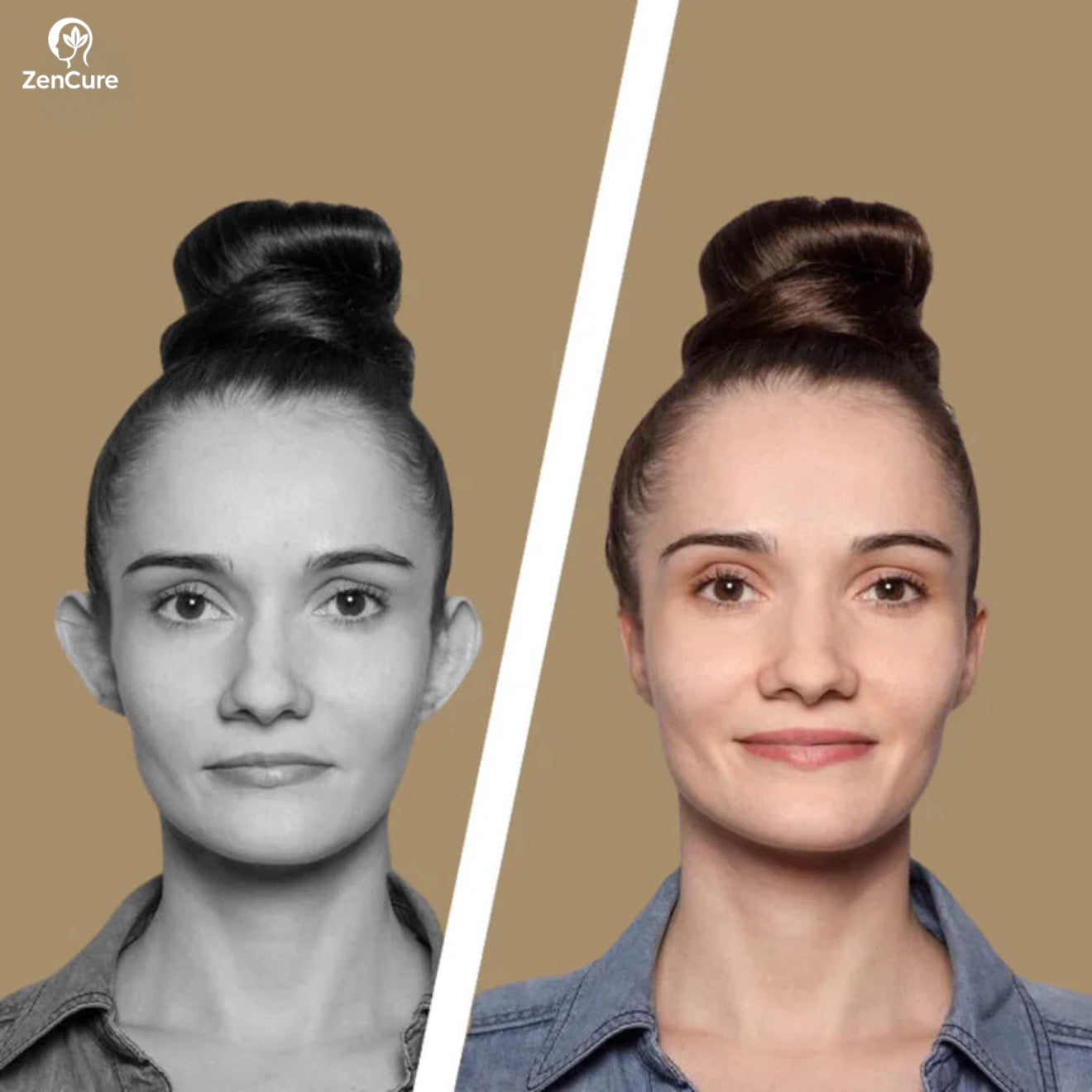 Otopatch™ Ear Correctors